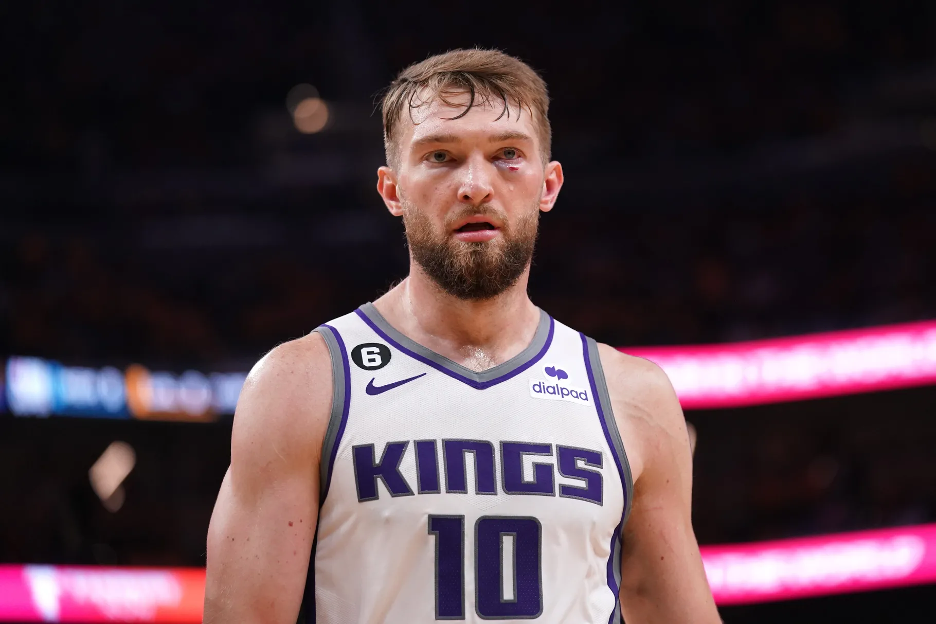 Domantas Sabonis has a black eye while wearing a kings jersey. Credit to Cary Edmondson-USA TODAY Sports
